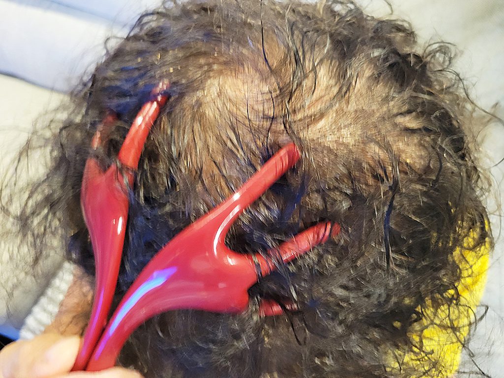 リグロ大作戦 リグロ ロート製薬 マッサージ風景