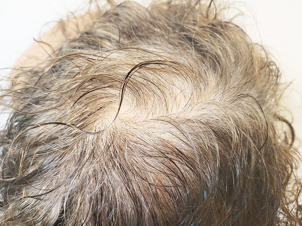 リグロ大作戦 リグロ ロート製薬 一ヶ月後の成果は? 頭上からの写真