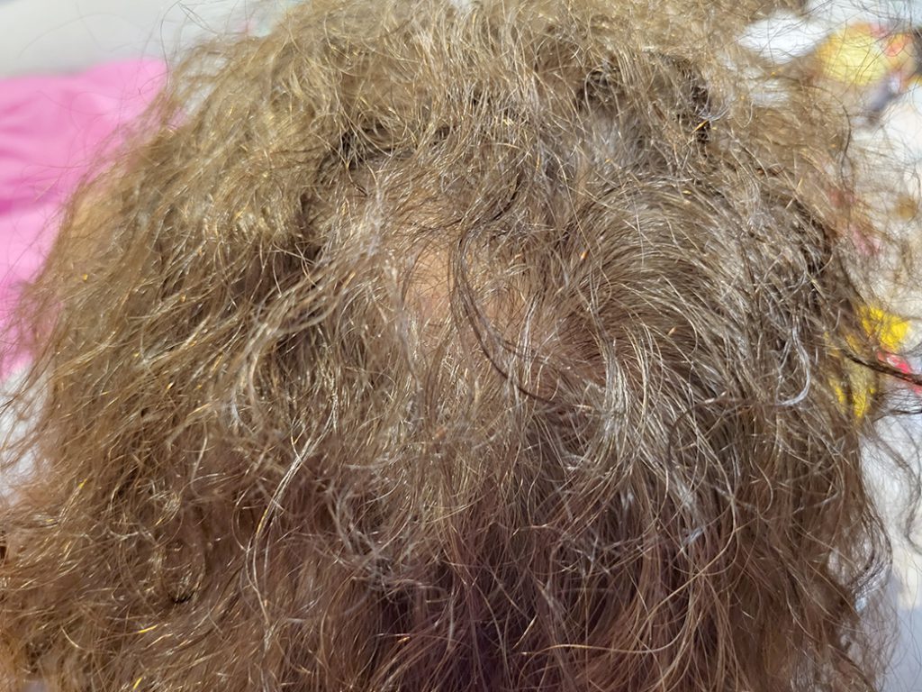 リグロ大作戦 リグロ ロート製薬 現状写真