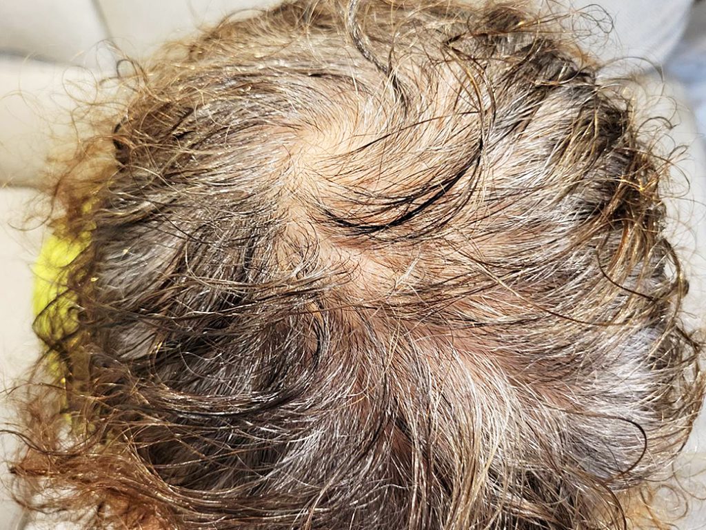 リグロ大作戦 リグロ ロート製薬 二ヶ月後の成果は? 頭上の写真