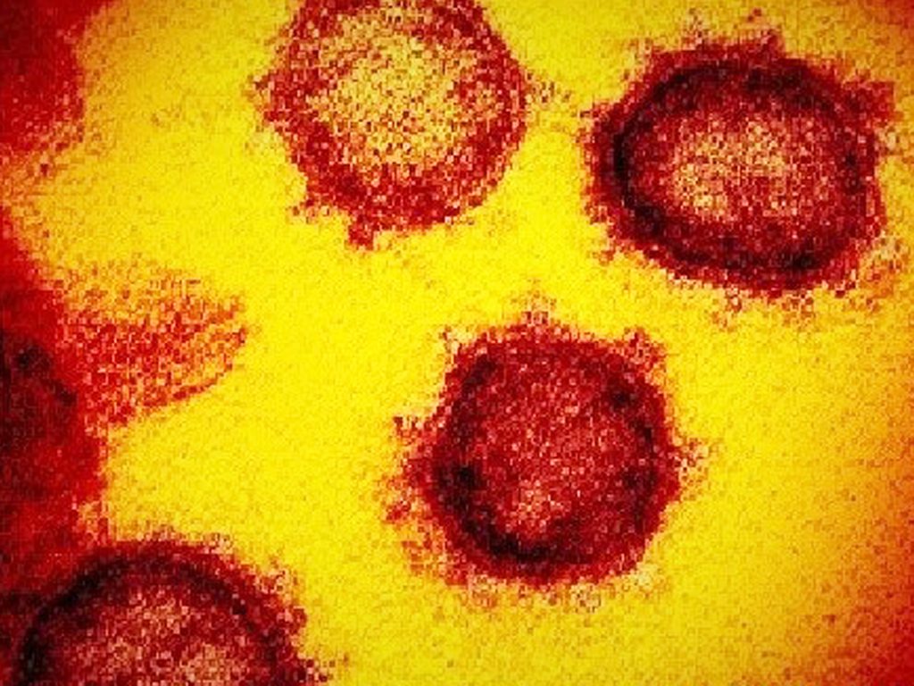 リグロ大作戦 新型コロナウイルス感染症(COVID‑19)に感染