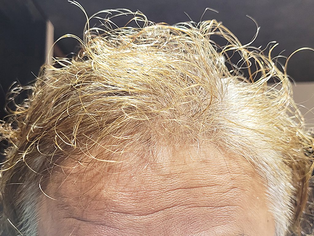 リグロ大作戦!第二章に突入w!!4ヶ月目のご報告 額の写真