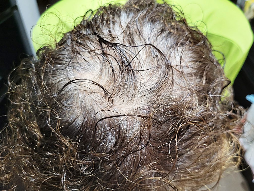 リグロ大作戦!第二章に突入w!!4ヶ月目のご報告 真上からの写真